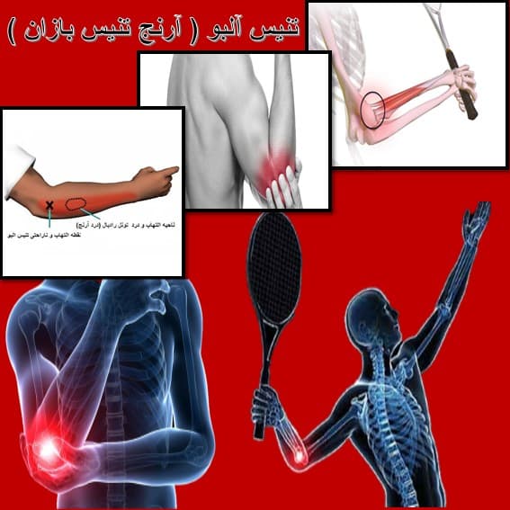 تنیس آلبو