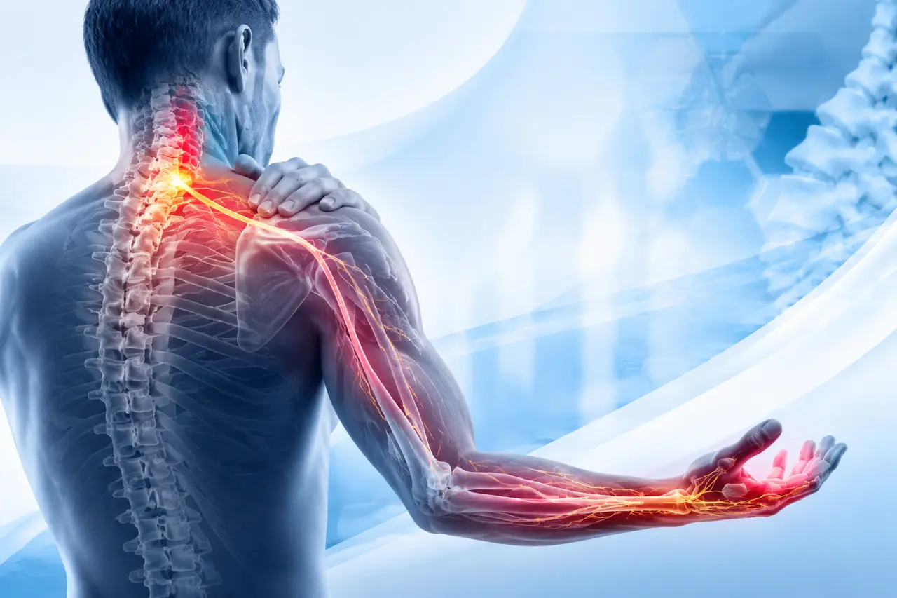 دیسک گردن چیست و چرا درد به دست تیر می‌کشد؟