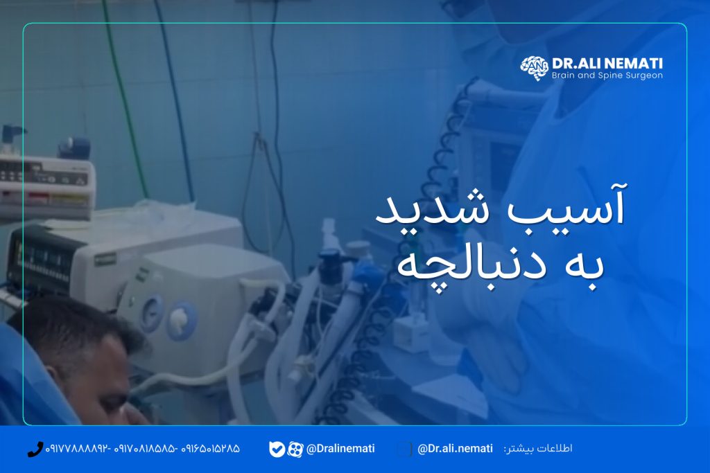 آسیب شدید به دنبالچه