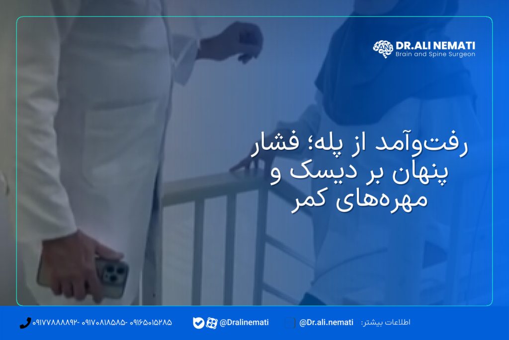 رفت‌وآمد از پله؛ فشار پنهان بر دیسک و مهره‌های کمر