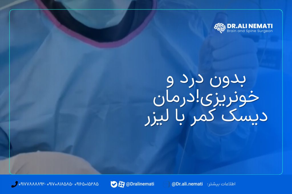 بدون درد و خونریزی!درمان دیسک کمر با لیزر
