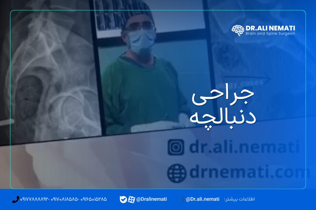جراحی دنبالچه