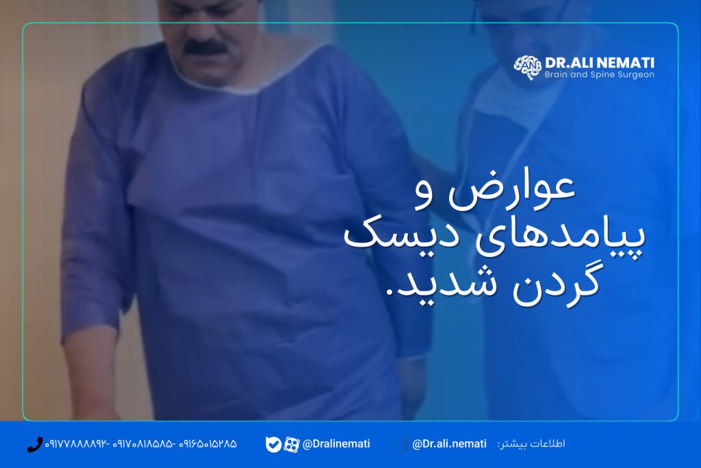 عوارض و پیامدهای دیسک گردن شدید.