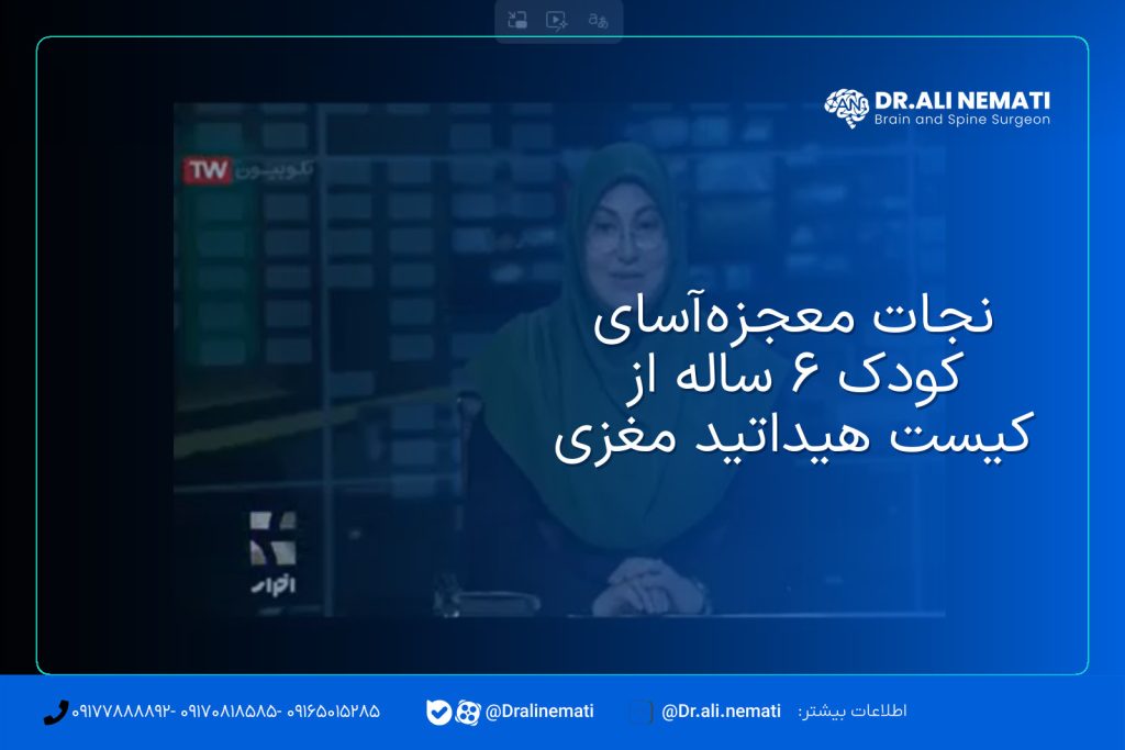 نجات معجزه‌آسای کودک ۶ ساله از کیست هیداتید مغزی