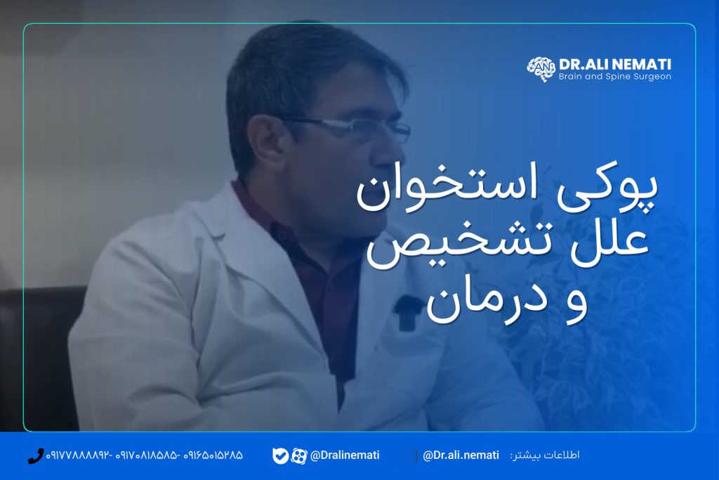 پوکی استخوان علل تشخیص و درمان