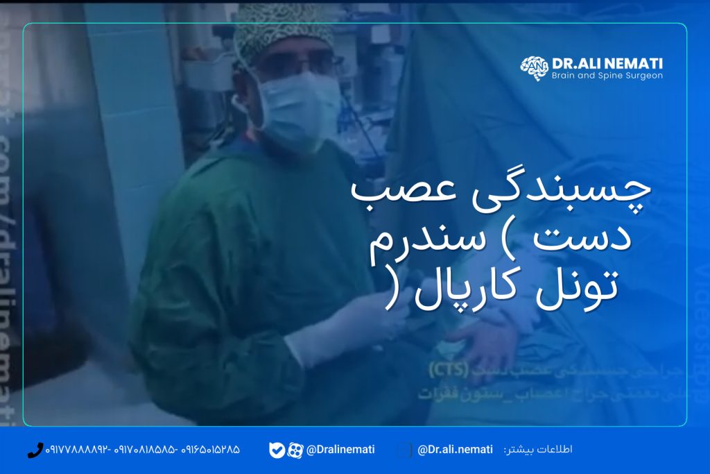 چسبندگی عصب دست ( سندرم تونل کارپال )