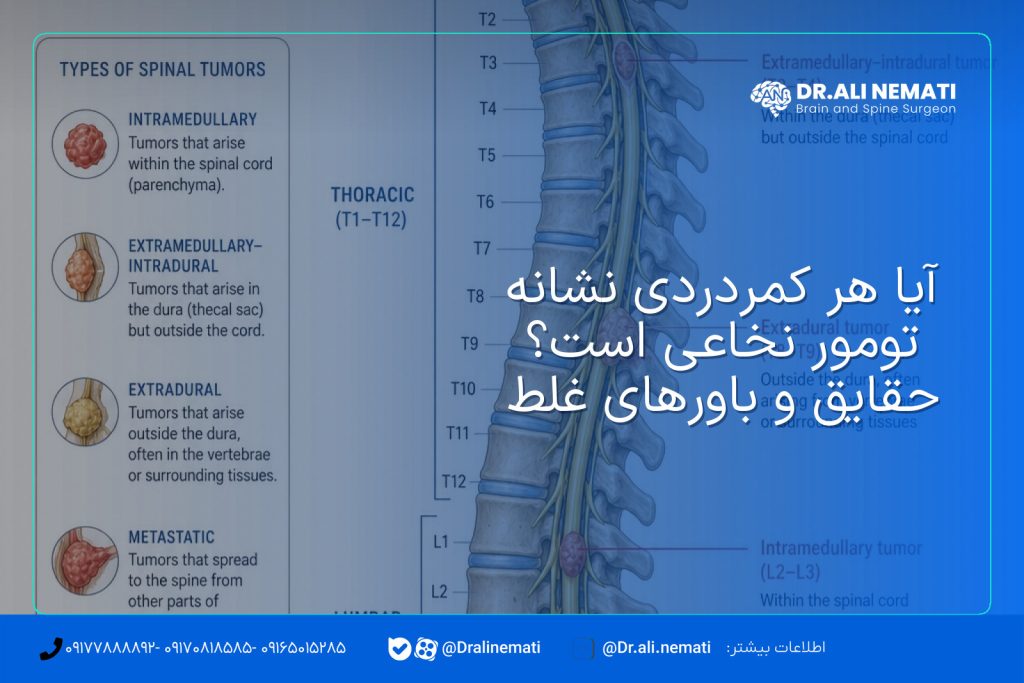 آیا هر کمردردی نشانه تومور نخاعی است؟ حقایق و باورهای غلط