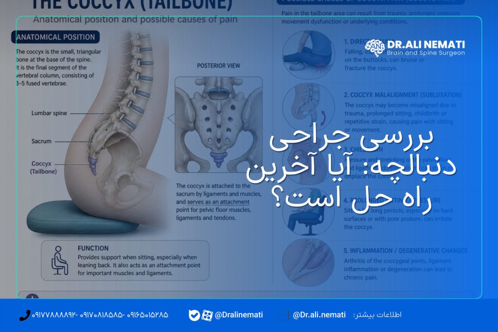 بررسی جراحی دنبالچه: آیا آخرین راه حل است؟
