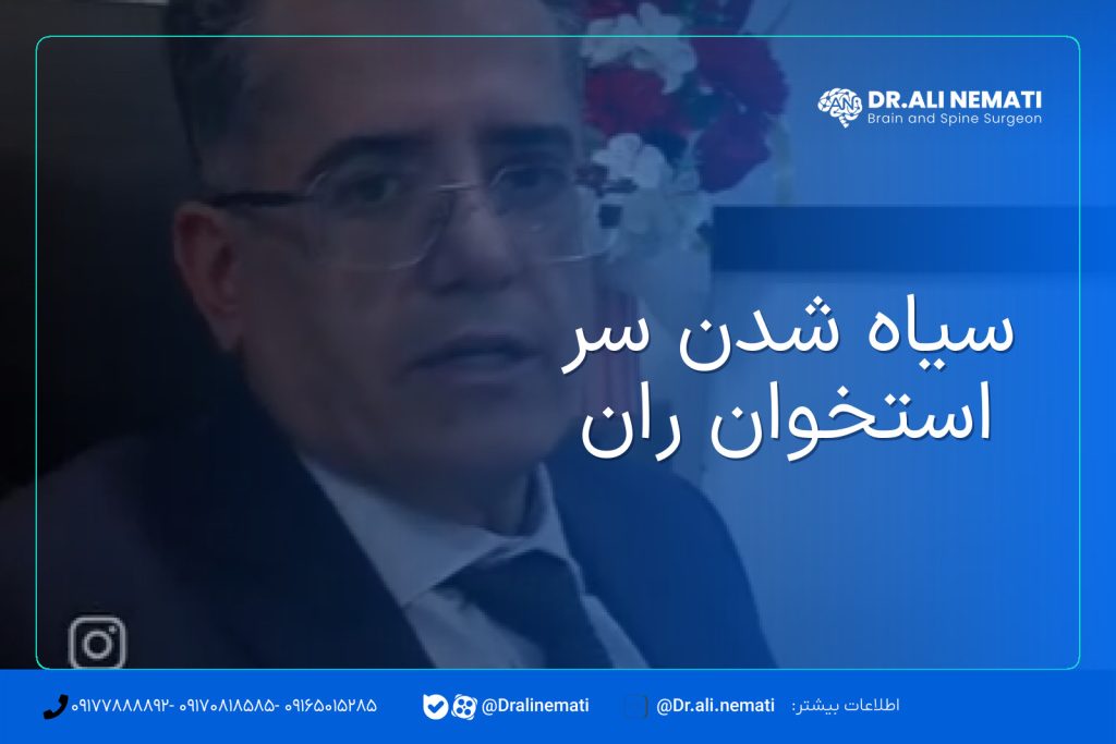 سیاه شدن سر استخوان ران
