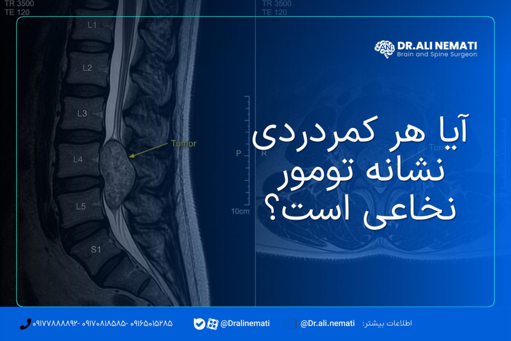 آیا هر کمردردی نشانه تومور نخاعی است؟