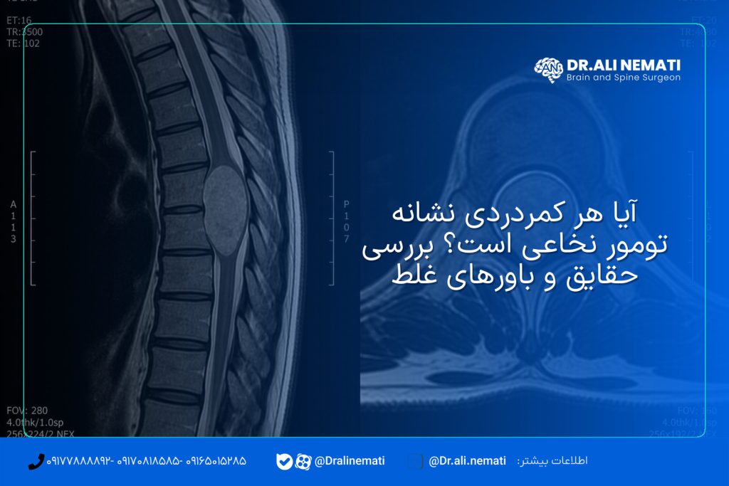آیا هر کمردردی نشانه تومور نخاعی است؟ بررسی حقایق و باورهای غلط